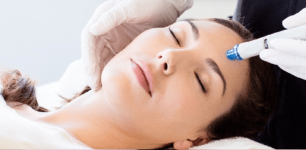 skin rejuvenation.png skin rejuvenation.png