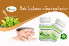 Granuloma Annulare, Herbal Supplements and Remedies are Helpful.jpg