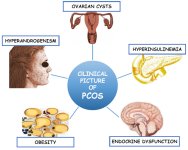 PCOS and PCOD.jpg PCOS and PCOD.jpg