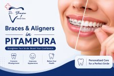 Braces & Aligners in Pitampura.jpg Braces & Aligners in Pitampura.jpg